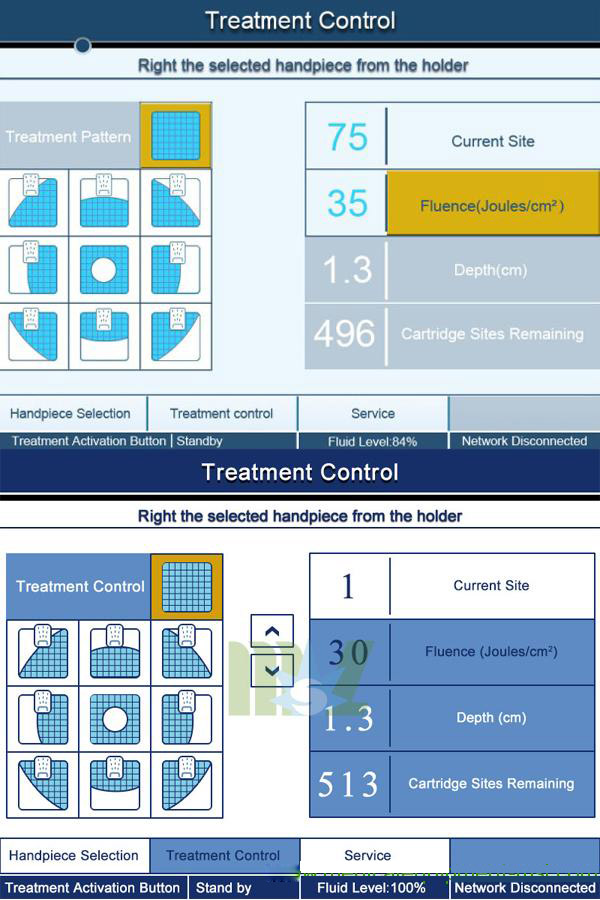 FAST result hifu body slimming machine