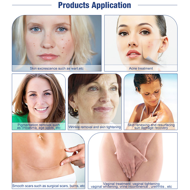 Best Laser Vaginal Tightening Machine MSLCF02