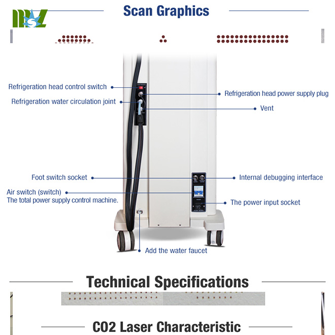 Advanced Laser Vaginal Tightening Machine MSLCF02 for sale