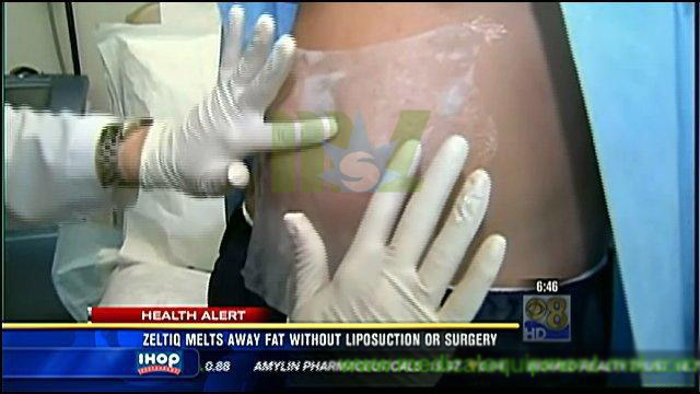 Use Fat freezing machine MSLCY01 for sale