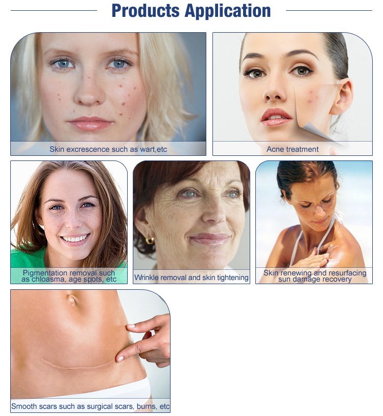 CO2 laser surgical system MSLCF03