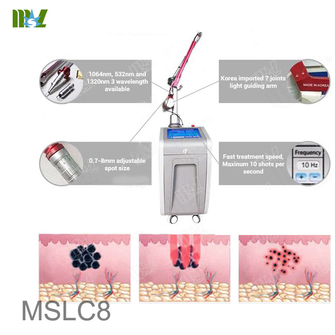 Q-switch YAG Laser pigmentation Removal