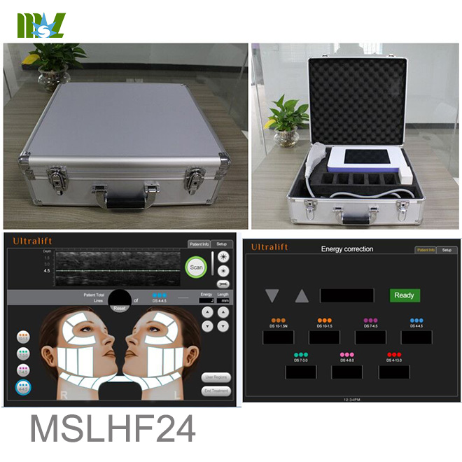 ultrasonic liposuction